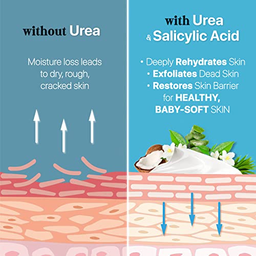 Urea Cream 40% Plus Salicylic Acid 4.6 Oz, Callus Remover Hand Cream Foot Cre...