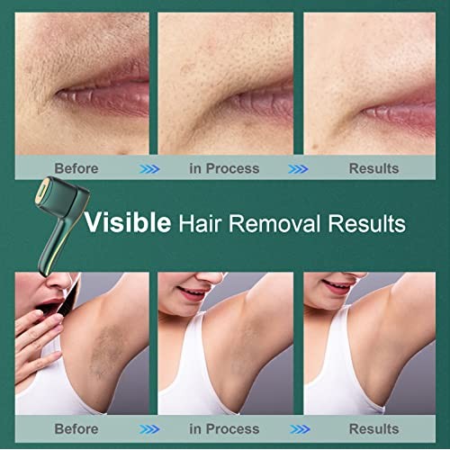 Ebotri Permanent IPL Hair Removal Device Cooling Painless Technology At-Home ...