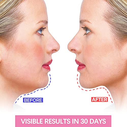 Double Chin Reducer, Face Slimming Strap, V Shaped Mask Chin UP Face Lifting ...