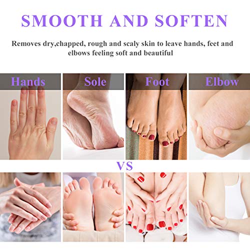 Paraffin Wax Machine for Hand and Feet - Ejiubas Paraffin Bath,Quick Heating,...