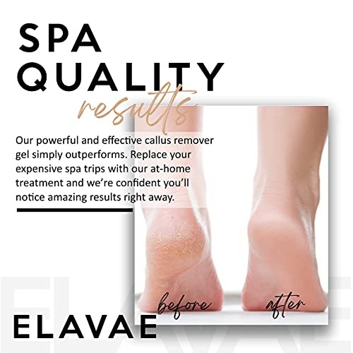 Elavae Callus Remover Gel Extra Strength. Works well with foot scrubber, file...
