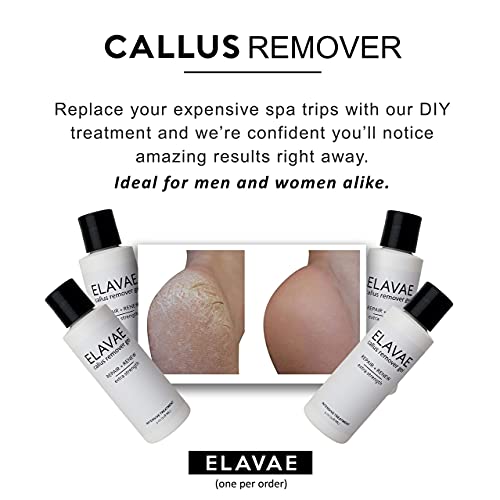 Elavae Callus Remover Gel Extra Strength. Works well with foot scrubber, file...