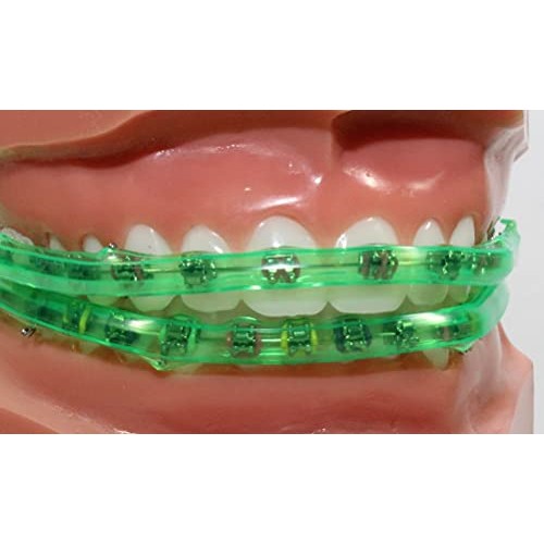 Element Braces Comfort Lip Bumper (Green) - Orthodontic - Dental