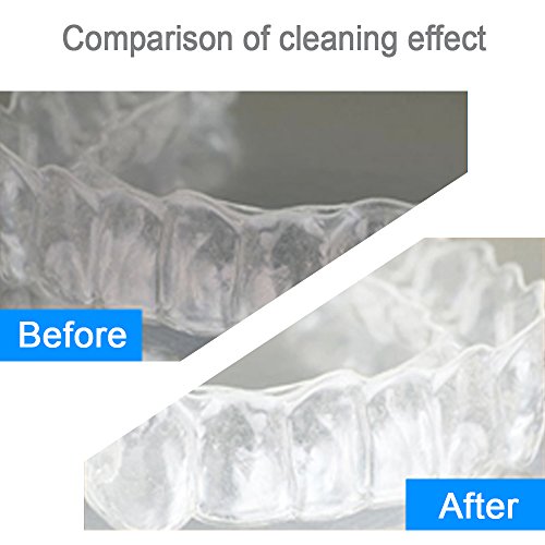 Elera Sonic Cordless Retainer Cleaner Machine, Denture Cleaner, Premium Jewel...