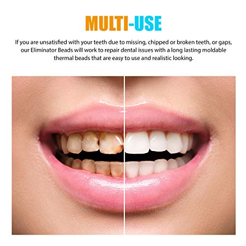 Do It Yourself Gap Eliminator Temporary Tooth Substitute With Sculpting Tool