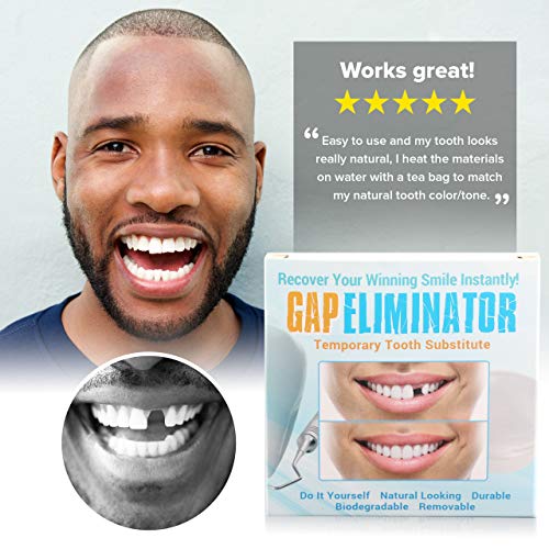 Do It Yourself Gap Eliminator Temporary Tooth Substitute With Sculpting Tool