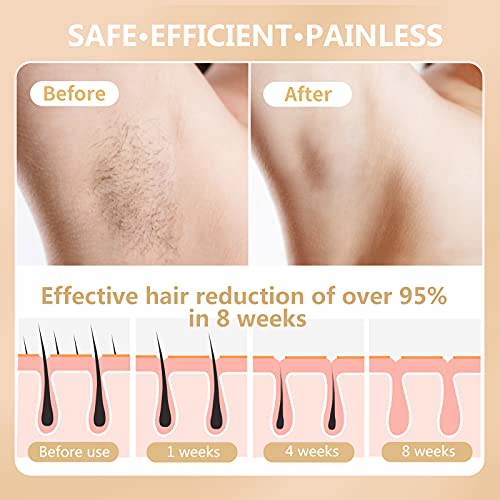 ELLKII LPL Hair Removal for Women and Men, Womens Permanent Ice Compress Pain...