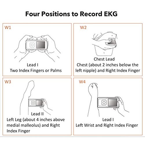 EMAY Portable ECG Monitor (for iPhone & Android, Mac & Windows) | Wireless EK...