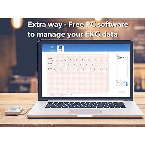 EMAY Portable EKG Monitoring Device (for iPhone & Android, Mac & Windows) | P...