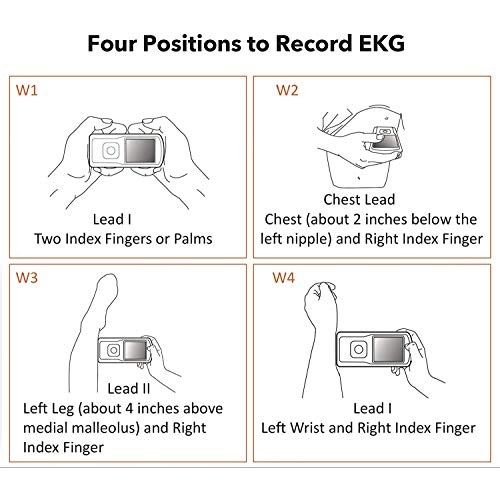 EMAY Portable EKG Monitoring Device (for iPhone & Android, Mac & Windows) | P...
