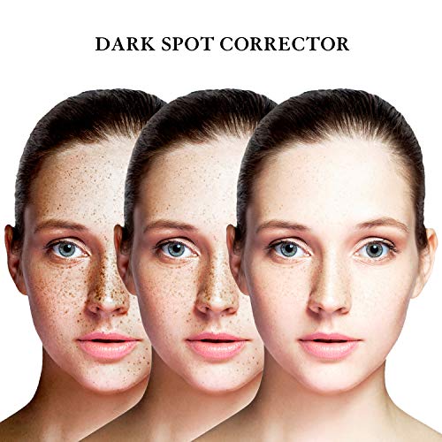 EnaSkin Dark Spot Corrector Remover for Face and Body, Formulated with Advanc...