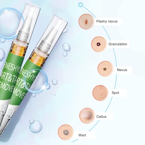 Skin Tag & Wart & Callus for Treating Kit, Treating your Skin Quickly and Eff...