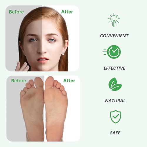 Skin Tag & Wart & Callus for Treating Kit, Treating your Skin Quickly and Eff...