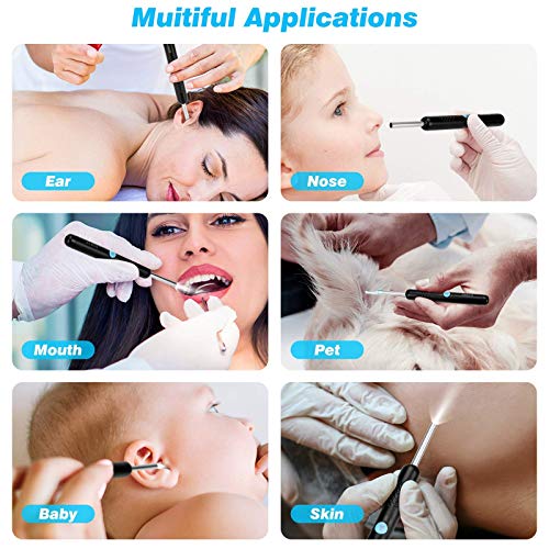 Ear Wax Removal, Enjoyee Ear Cleaner Ear Wax Removal Kit, Wireless Ear Wax Re...