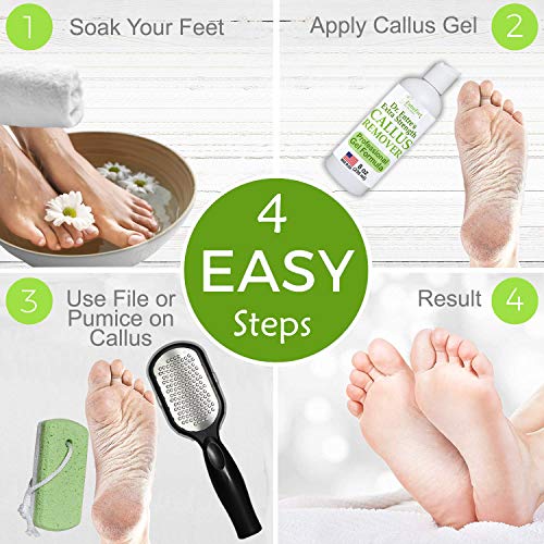 Dr. Entre's Callus Remover Kit for Feet: 8oz Callus Remover Gel, Foot File, P...