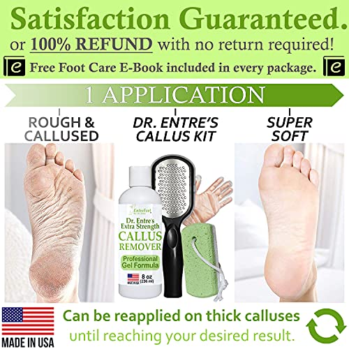 Dr. Entre's Callus Remover Kit for Feet: 8oz Callus Remover Gel, Foot File, P...