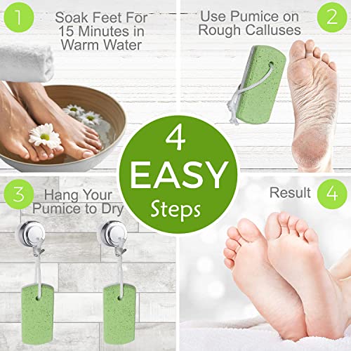 Dr. Entre's Pumice Stone for Feet 4 Pack: Callus Remover, Dead Skin Scraper, ...
