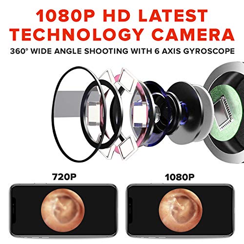 eoglo Ear Wax Removal Tool Camera, Extra Thin (3.9mm) with 6 LED Lights, HD 1...