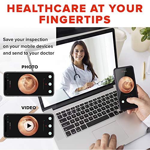 eoglo Ear Wax Removal Tool Camera, Extra Thin (3.9mm) with 6 LED Lights, HD 1...