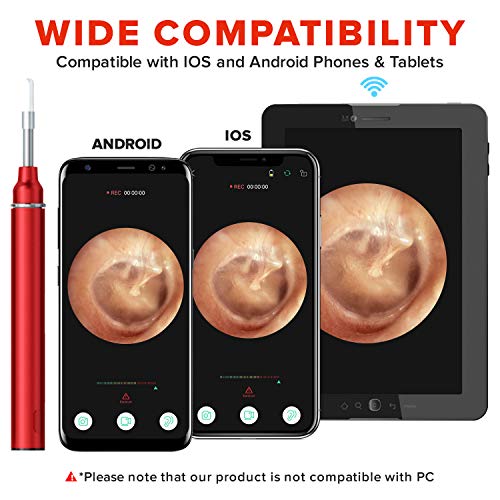 eoglo Ear Wax Removal Tool Camera, Extra Thin (3.9mm) with 6 LED Lights, HD 1...