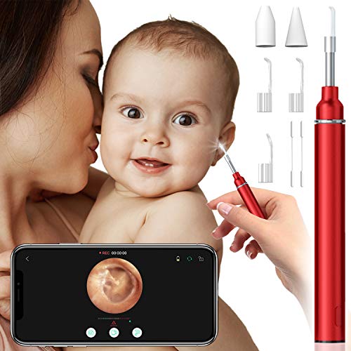 eoglo Ear Wax Removal Tool Camera, Extra Thin (3.9mm) with 6 LED Lights, HD 1...