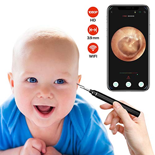 eoglo Ear Wax Removal Tool Camera, Smart Visual Ear Inspection Cleaner, Extra...