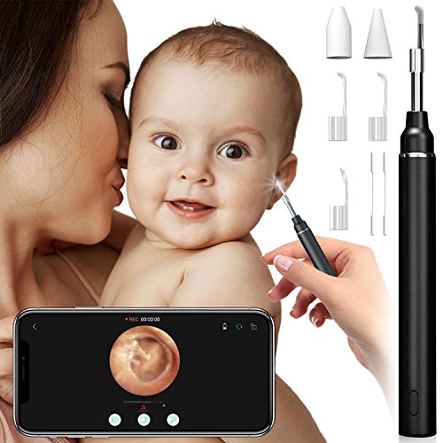 eoglo Ear Wax Removal Tool Camera, Smart Visual Ear Inspection Cleaner, Extra...