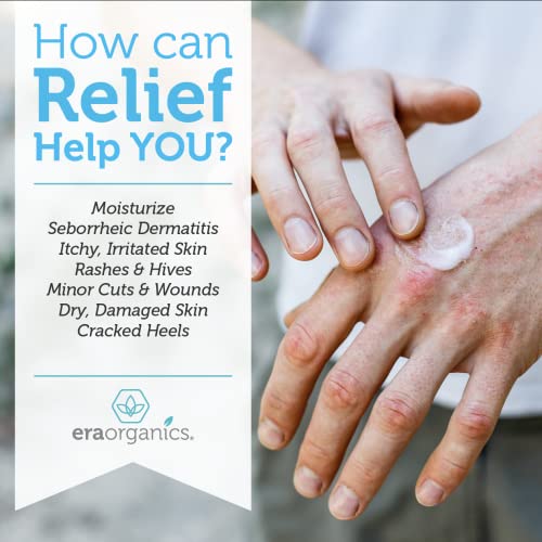 Era Organics Eczema, Psoriasis & Dermatitis Moisturizer Cream - Advanced 15-i...