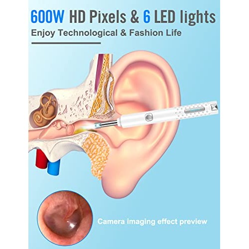 Ear Wax Removal Tool Camera,Ear Cleaner Camera Kit,Spade Ear Cleaning,1920P H...