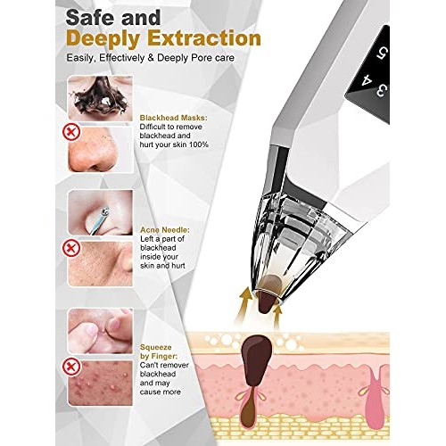 Blackhead Remover Pore Vacuum EUHOME Electric Rechargeable Blackhead Whitehea...