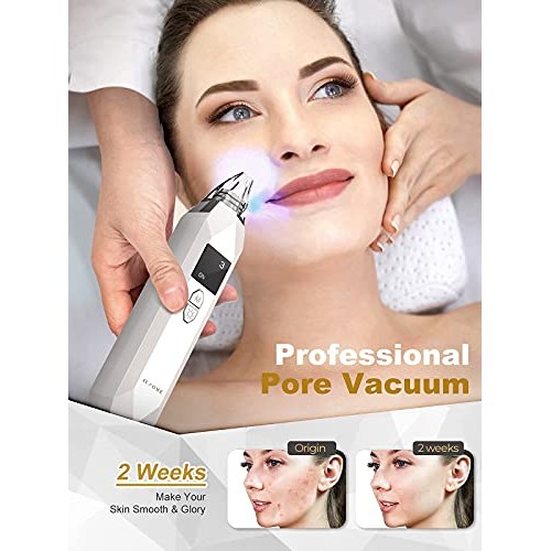 Blackhead Remover Pore Vacuum EUHOME Electric Rechargeable Blackhead Whitehea...