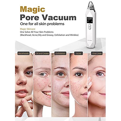 Blackhead Remover Pore Vacuum EUHOME Electric Rechargeable Blackhead Whitehea...