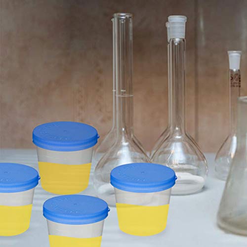 EXCEART 50pcs Urine Specimen Cups Urine Specimen Collection Cups with Lids fo...