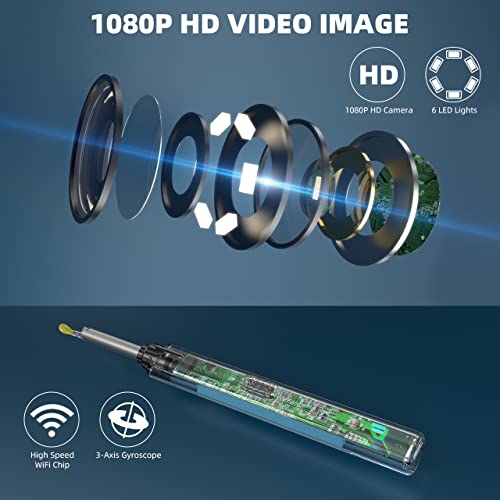 Exellewis Ear Wax Removal, Ear Cleaner Camera, Ear Camera with Light, Ear Cle...