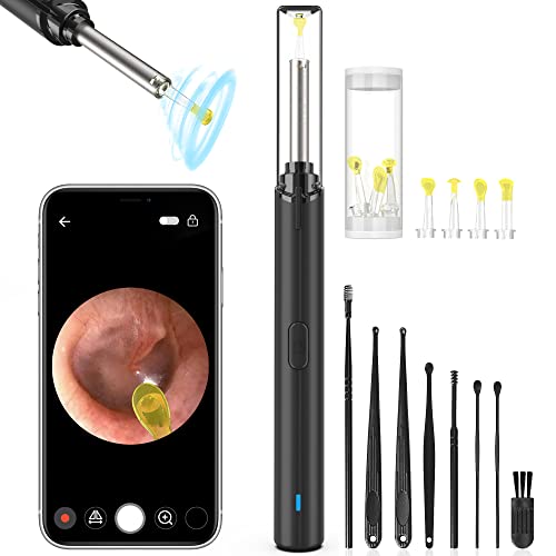 Exellewis Ear Wax Removal, Ear Cleaner Camera, Ear Camera with Light, Ear Cle...