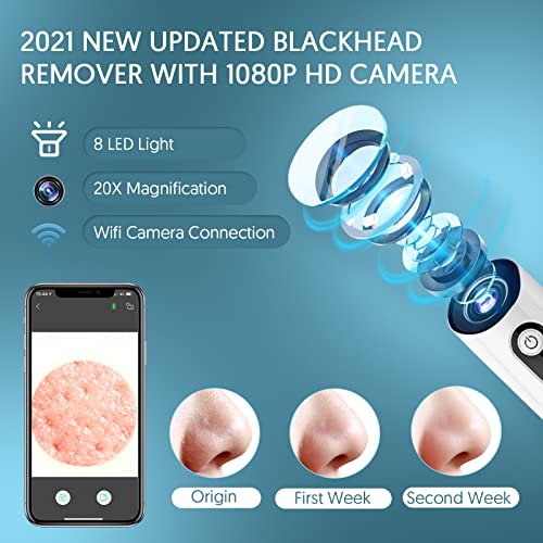 EXEMPT Blackhead Remover Vacuum with Camera, Visible Pore Vacuum, Pimple Popp...