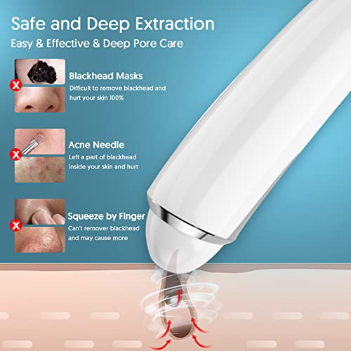 EXEMPT Blackhead Remover Vacuum with Camera, Visible Pore Vacuum, Pimple Popp...