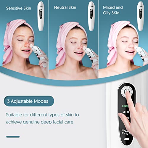 EXEMPT Blackhead Remover Vacuum with Camera, Visible Pore Vacuum, Pimple Popp...