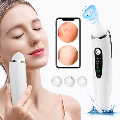 EXEMPT Blackhead Remover Vacuum with Camera, Visible Pore Vacuum, Pimple Popp...