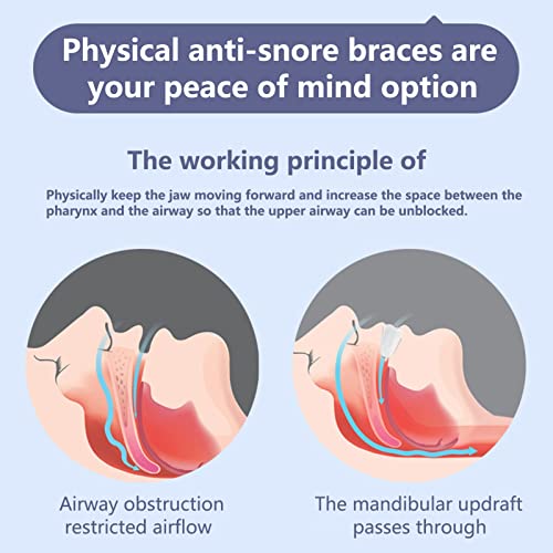 ExhilaraZ Teeth Guard Sleep Better Breath Aid Apnea Stooper Soft for Unisex Blue