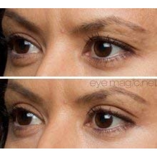 Eye Magic Original Eye Lift Kit (Small/Medium)