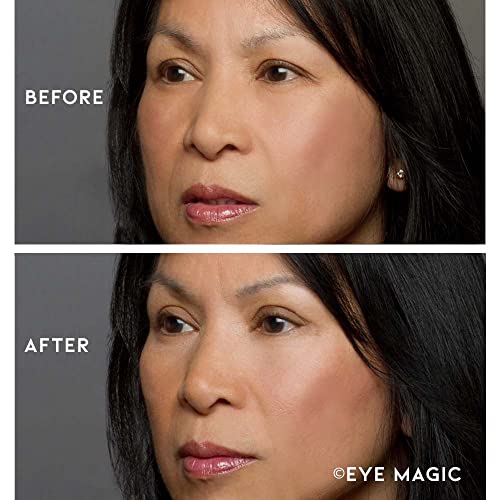 Eye Magic Premium Instant Eyelid Lift (L/XL Refill). Made in America - Lifts ...