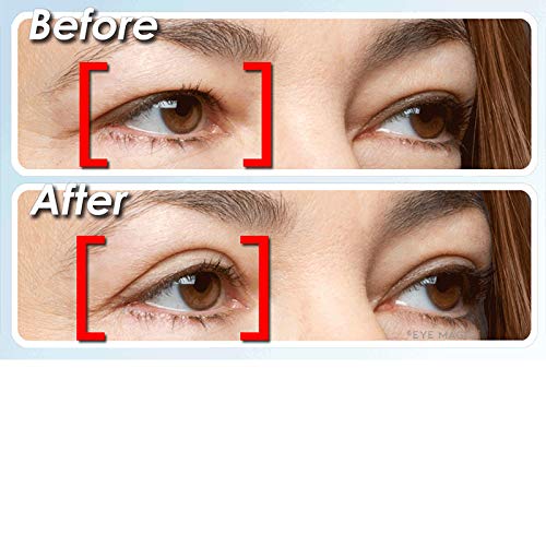 Eye Magic Premium Instant Eyelid Lift (S/M Refill). Made in America - Lifts a...