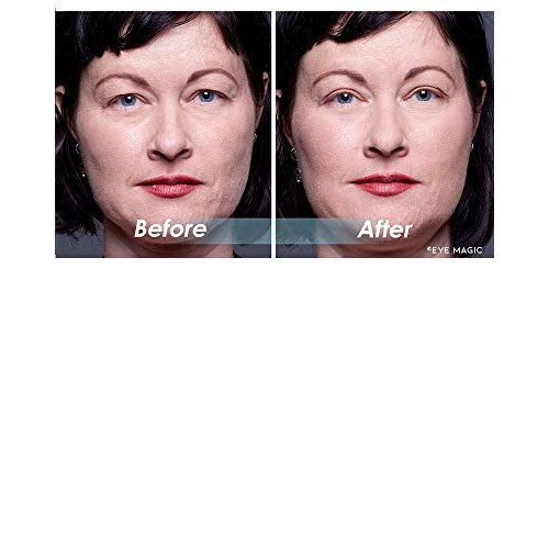 Eye Magic Premium Instant Eyelid Lift (S/M Refill). Made in America - Lifts a...