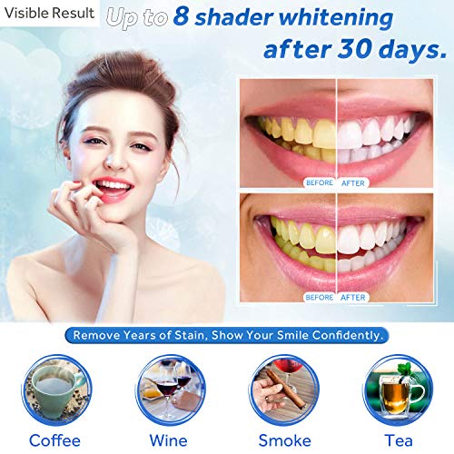 EZGO 10 Pack Teeth Whitening Gel Refills 22% Bleaching Gel, No Sensitive Teet...