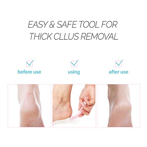 F3 Systems Callus Razor, Pedicure Tool, Effective for Cracked Heel, Ergonomic...