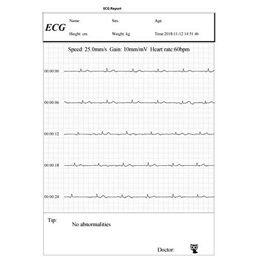 Facelake FL10 Portable ECG/EKG Monitor with Bluetooth for iOS and Android