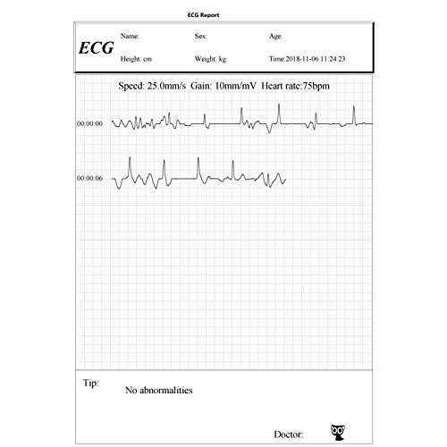 Facelake FL10 Portable ECG/EKG Monitor with Bluetooth for iOS and Android