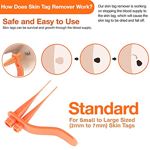 2022 Skin Tag Removal Mole Kit, 2-in-1 Skin Tags & Moles Remover Patches, Bod...