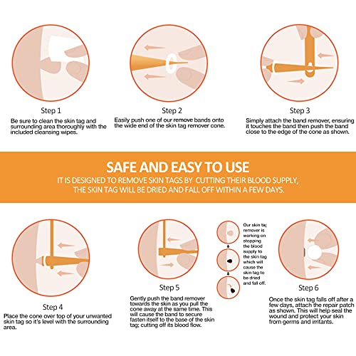 2022 Skin Tag Removal Mole Kit, 2-in-1 Skin Tags & Moles Remover Patches, Bod...